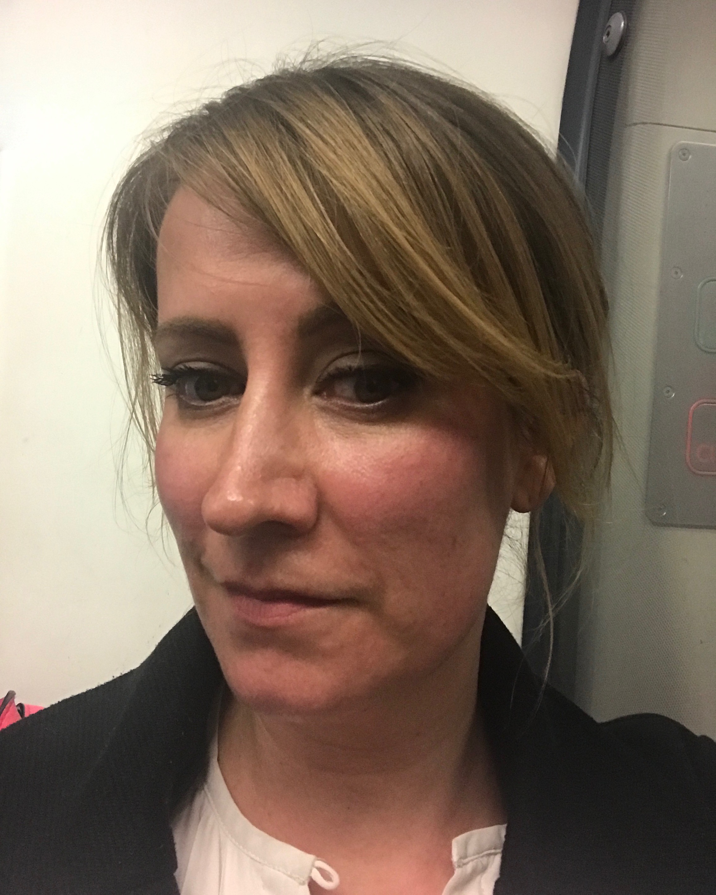 Transform non-surgical beauty treatments peel after shot
