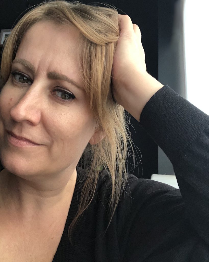 How to reduce the frown lines between your eyebrows - after shot