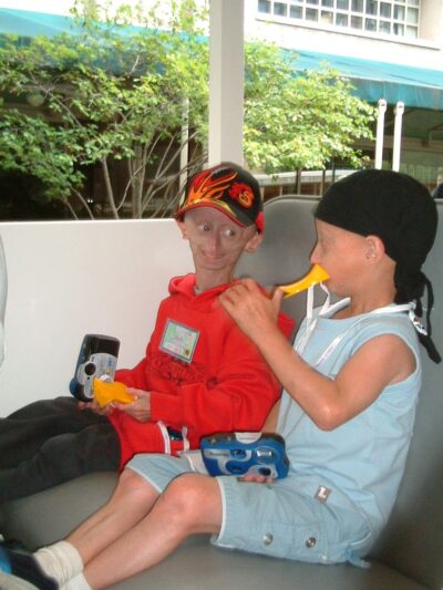 THE OLDEST LITTLE KIDS IN THE WORLD // my life-changing visit to the progeria reunion